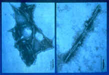 Particulas al microscopio electrnico.